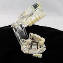 Complete Teeth Restoration Study with Dental Implant Model, Removable Bridge