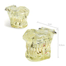 1pc Dental Implant Disease Teeth Model with Restoration & Bridge Tooth