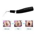 Dental Wireless Ultrasonic Operation Endo Ultrasonic Activator