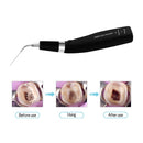 Dental Wireless Ultrasonic Operation Endo Ultrasonic Activator